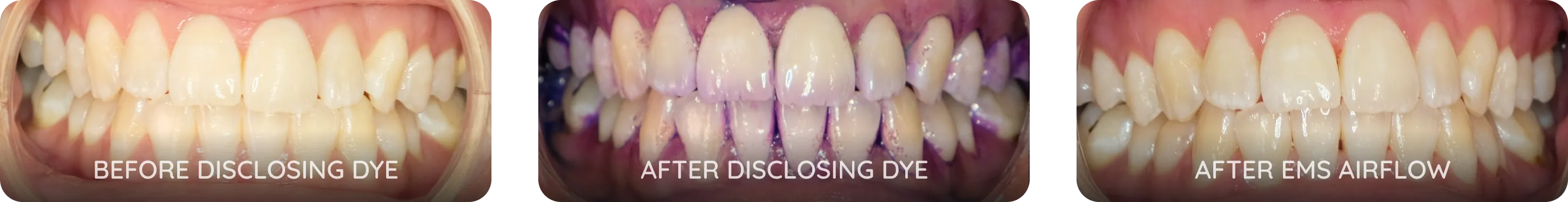 Cleaner and brighter in one visit